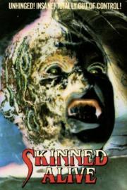 Skinned Alive