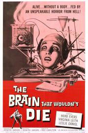 The Brain That Wouldn\